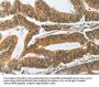 PIK3R3 Antibody