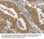 PIK3R3 Antibody