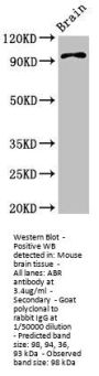 ABR Antibody