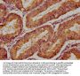 MTMR3 Antibody