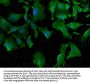 MTMR3 Antibody