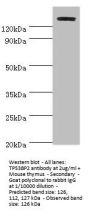 TP53BP2 Antibody