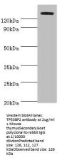 TP53BP2 Antibody