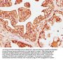 CAPS Antibody