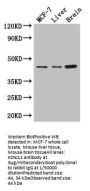 KCNJ11 Antibody