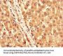 KCNJ11 Antibody