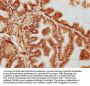 GOLGB1 Antibody