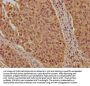 KPNB1 Antibody