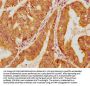 LLGL1 Antibody