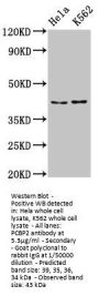 PCBP2 Antibody