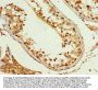 PCBP2 Antibody