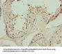 TRIP13 Antibody