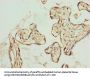TRIP13 Antibody