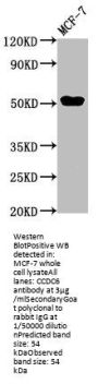 CCDC6 Antibody