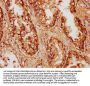 CCDC6 Antibody