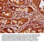 CCDC6 Antibody