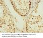 UBE2S Antibody