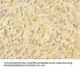 UBE2S Antibody