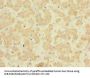 FAM187B Antibody