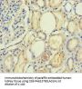 PLA2R1 Antibody