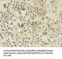 Rabbit anti-human Activin receptor type-2B polyclonal Antibody(ACVR2B)