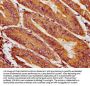 HIC1 Antibody