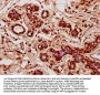 HIC1 Antibody