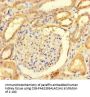 Rabbit anti-human Rho GTPase-activating protein 19 polyclonal Antibody
