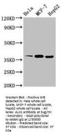 ALX1 Antibody