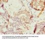 TAF12 Antibody