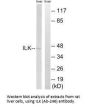 ILK (Ab-246) Antibody
