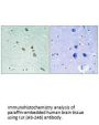 ILK (Ab-246) Antibody