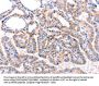 ADRBK1 Antibody