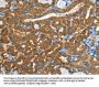 EPHB3 Antibody