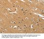 EPHB3 Antibody