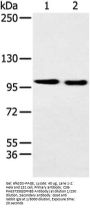 EPHB3 Antibody