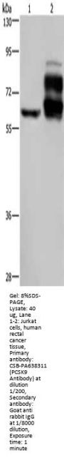 PCSK9 Antibody
