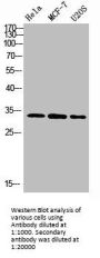 NANOS1 Antibody