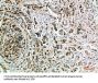 NANOS1 Antibody