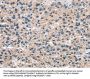 Rabbit anti-human A4GALT polyclonal antibody