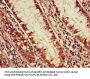PDS5A Antibody