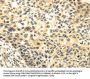 CDKN1A Antibody