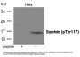 Phospho-BIRC5 (Thr117) Antibody