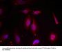 Phospho-ATF2 (Thr69 or 51) Antibody