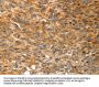 SOX11 Antibody