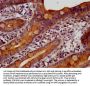 TKFC Antibody