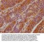 TBC1D25 Antibody
