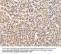 Rabbit anti-human VPS45 polyclonal antibody