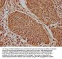 PLA2G4E Antibody