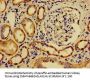 SREBF2 Antibody